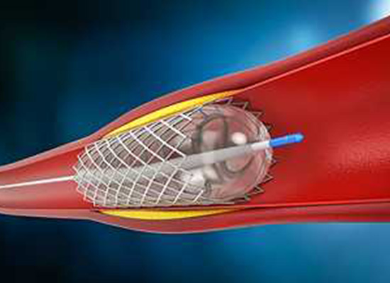 Digitales Bild vom Innenraum einer Vene