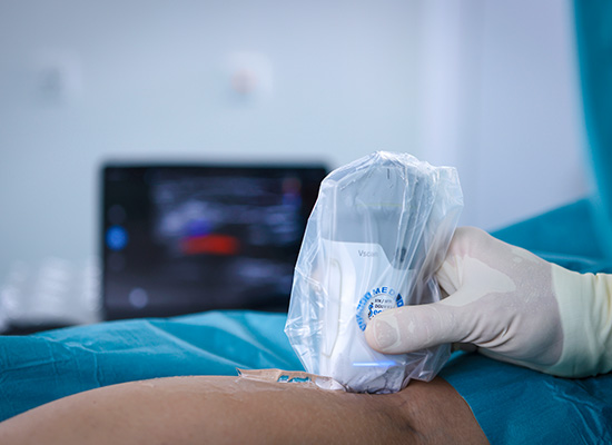 Bild von Ultraschall