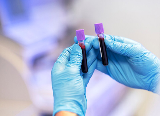 Bild von zwei Blutproben